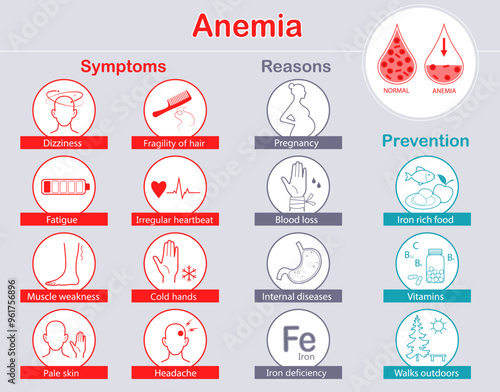 Infographic of anemia symptoms, reasons and prevention. Medical info poster. Set of Icons. Flat vector illustration