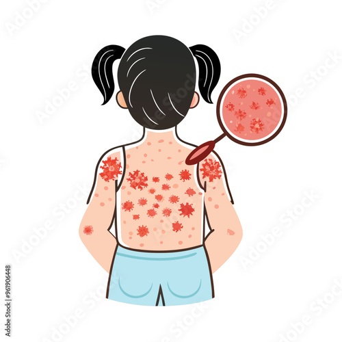 Allergic itching skin inflammation redness and irritation A child with allergies Healthcare (1)