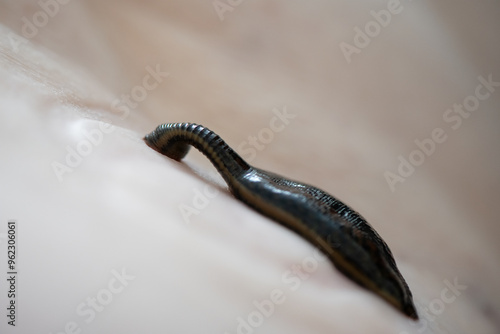 Close-up of medical leech bites the patient, selective focus. Hirudotherapy procedure. Hirudotherapy, Ethnoscience and Alternative medicine. Bloodletting and rejuvenation treatment. photo