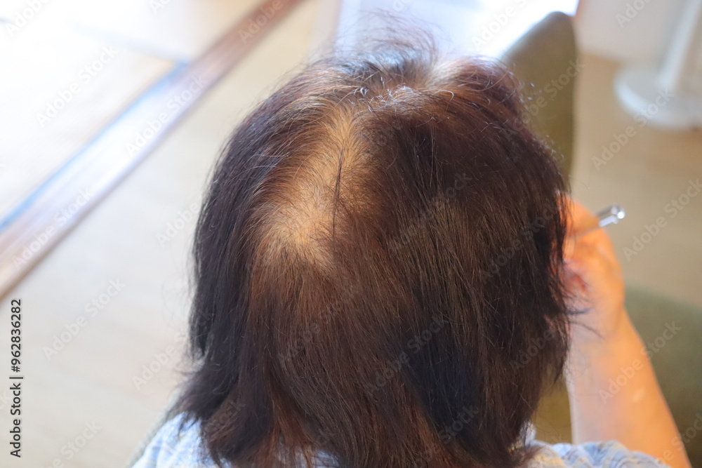 Naklejka premium 女性の薄毛、歯磨きする