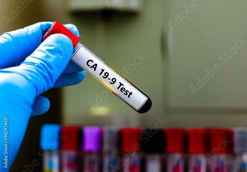 Blood sample tube for CA 19-9 test analysis. photo