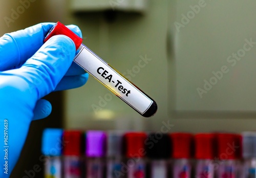 Blood sample tube for carcinoembryonic antigen (CEA) test analysis. photo