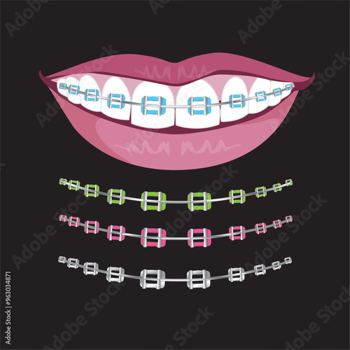 Continuous line art of Orthodontic treatment. Dentists day and respect for their services to humanity. Dental procedures vector art concept.