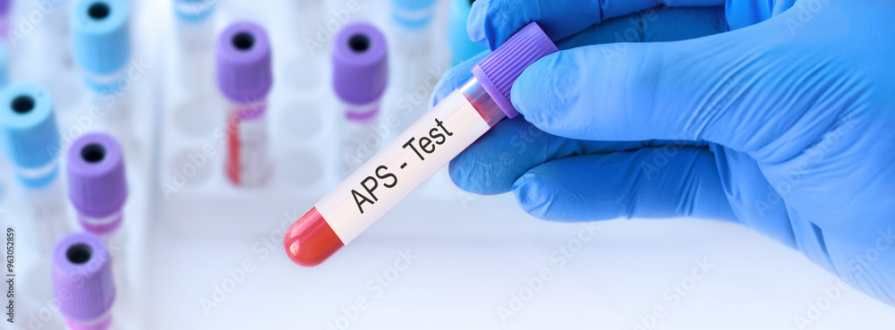 Naklejka premium Doctor holding a test blood sample tube with antiphospholipid syndrome (APS) test on the background of medical test tubes with analyzes.