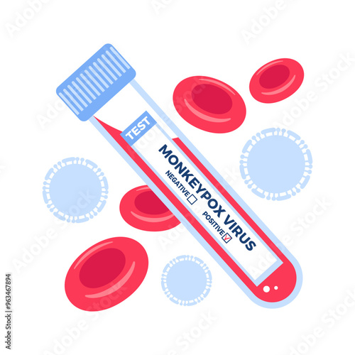 Laboratory tube containing a blood sample of the monkeypox virus for analysis, research. Epidemic outbreak concept. Serological test, red blood cells Vector illustration for medical brochures, website
