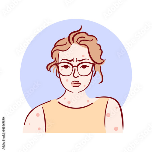The illustration shows a young woman with a miserable expression on her face and a rash all over her body. Vector illustration, sketch style for medical brochures, website. Monkey pox outbreak concept