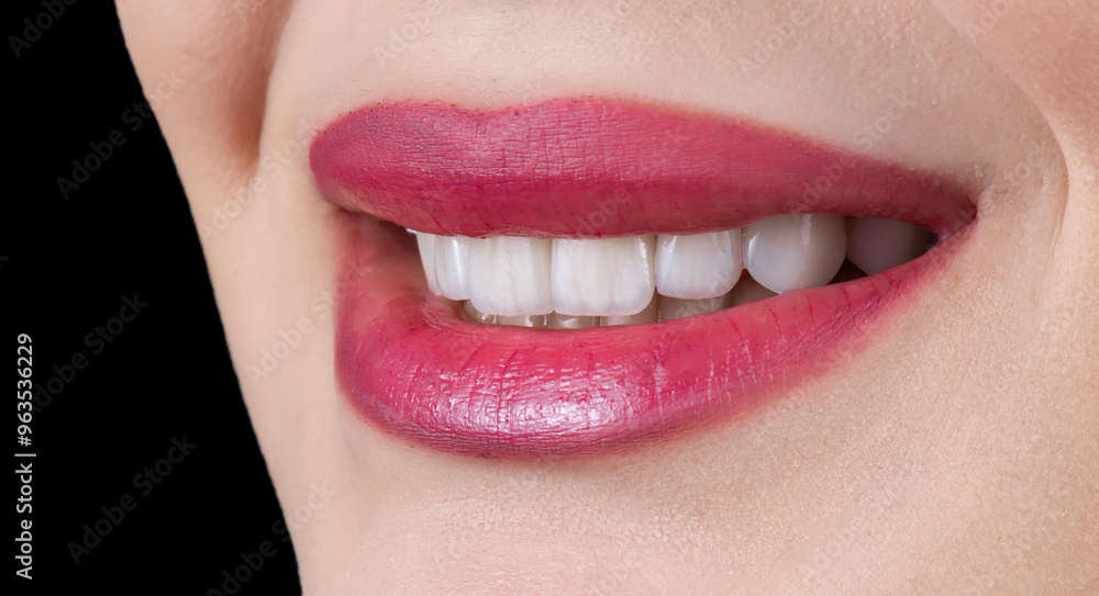 Obraz premium ceramic veneers b1 color