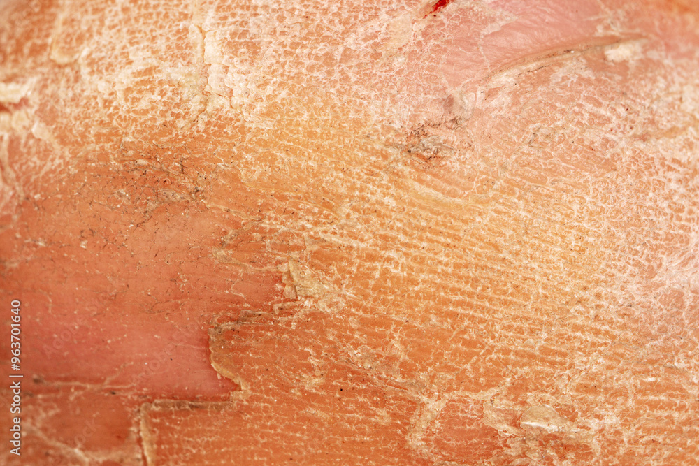 Fototapeta premium Fragment of cracked skin from a female heel
