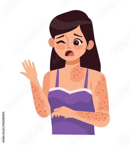 girl with monkey pox virus symptoms