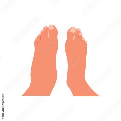 Swollen foot, normal foot. Before, after. Healthcare illustration. Vector illustration.