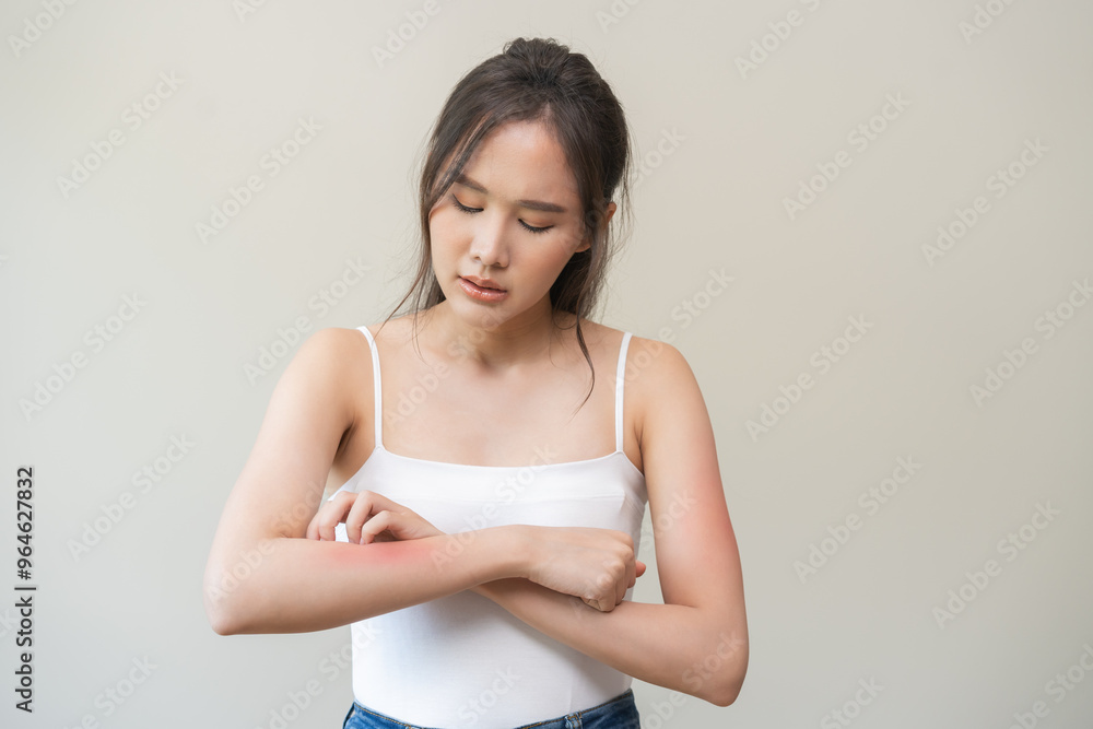 Dermatology, asian young woman reaction from atopic, insect bites on her arm, hand in scratching itchy red spot or rash of skin. Healthcare, treatment of beauty. Dermatology, asian young woman reaction from atopic, insect bites on her arm, hand in scratching itchy red spot or rash of skin. Healthcare, treatment of beauty.