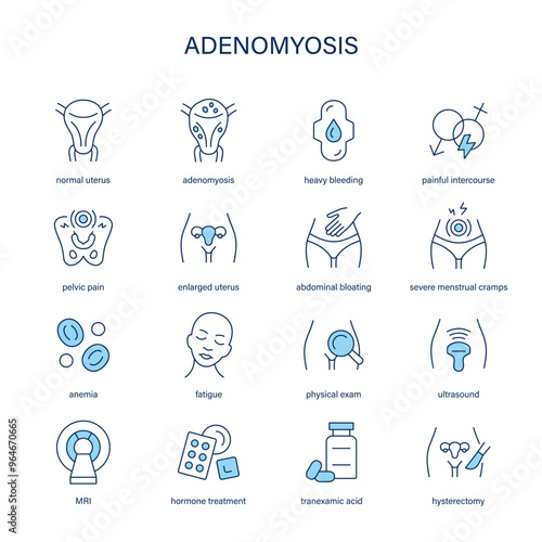 Adenomyosis symptoms, diagnostic and treatment vector icons. Medical icons.