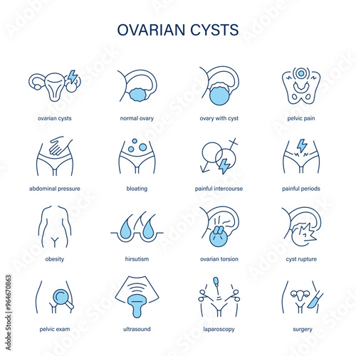 Ovarian Cysts symptoms, diagnostic and treatment vector icons. Medical icons.