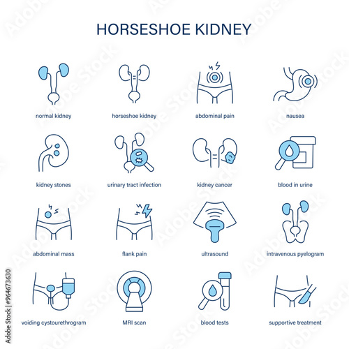 Horseshoe Kidney symptoms, diagnostic and treatment vector icons. Medical icons.