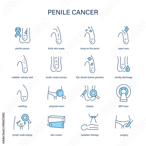 Penile Cancer symptoms, diagnostic and treatment vector icons. Medical icons.
