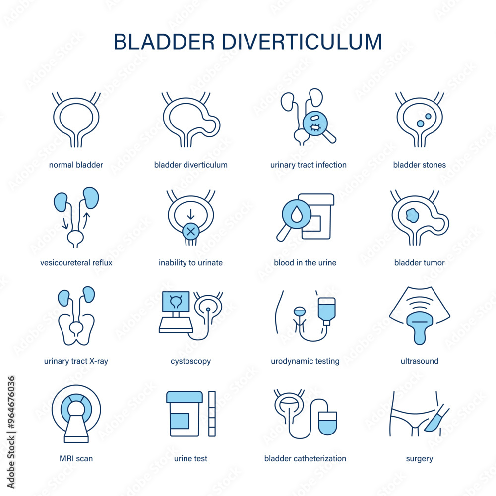Bladder Diverticulum symptoms, diagnostic and treatment vector icons. Medical icons. Bladder Diverticulum symptoms, diagnostic and treatment vector icons. Medical icons.