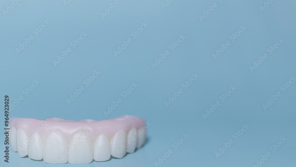 Fototapeta premium Implant-supported hybrid prosthesis