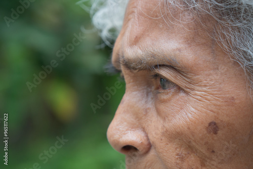 Elderly Asian woman looking up and Cataract eyes awaiting treatment
