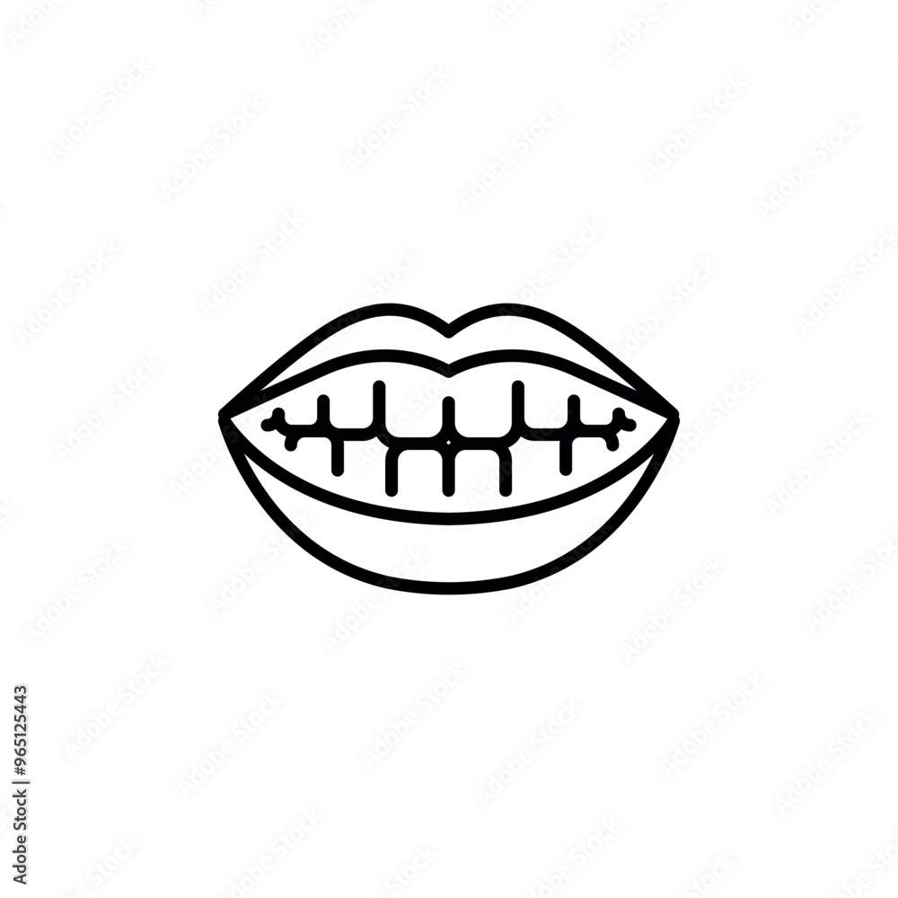 Smile with braces icon. Simple icon of a smiling mouth with braces for social media, app, and web design. Vector illustration. Smile with braces icon. Simple icon of a smiling mouth with braces for social media, app, and web design. Vector illustration.