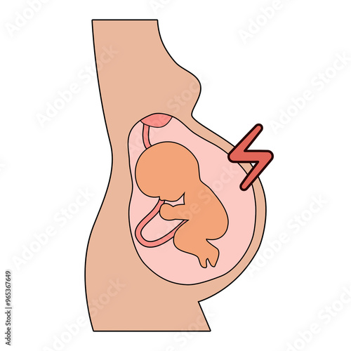 Preeclampsia symptoms and diagnostic vector icons. Pregnancy pregnant complications. Health and Medical icon illustration.