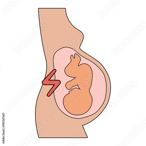 Preeclampsia symptoms and diagnostic vector icons. Pregnancy pregnant complications. Health and Medical icon illustration.