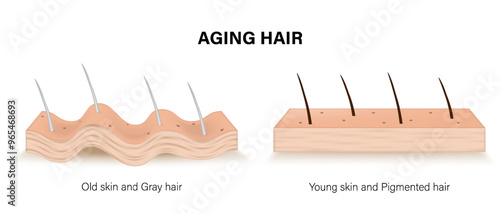 Aging hair. Old skin and gray hair with Young skin and pigmented hair. Due to increasing age Hair becomes gray due to the loss of melanin. aging process.