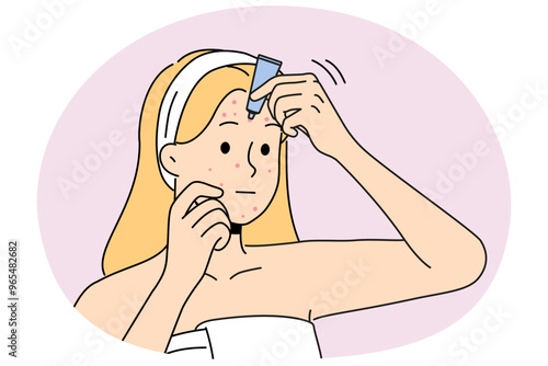 Woman in bathrobe apply cream on pimples on face. Unhappy girl treat redness struggle with facial problems. Skincare and beauty. Vector illustration.