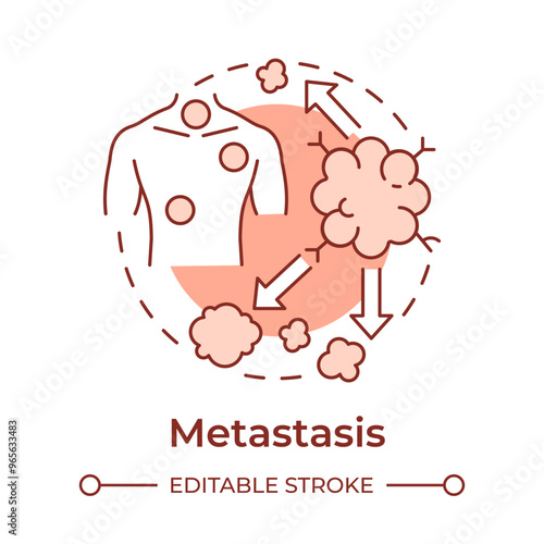 Metastasis soft red concept icon. TNM system. Cancer spread. Pathogenic tumor. Secondary cancer. Round shape line illustration. Abstract idea. Graphic design. Easy to use in article photo