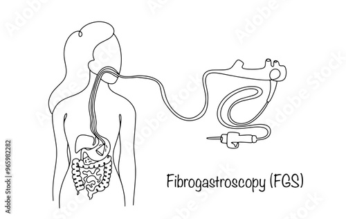 Fibrogastroscopy
