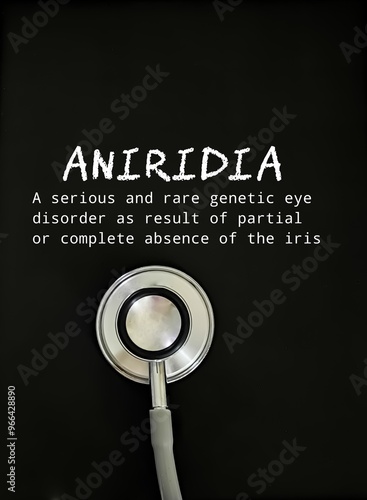 Aniridia, is defined as a partial or complete absence of the iris. photo