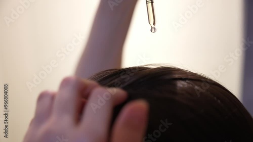 Close-Up of Woman Applying Dermatological Serum to Scalp Using a Dropper and Hands