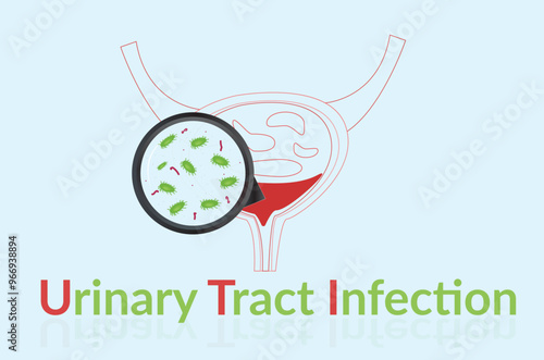 Urinary tract infection(UTI) vector. Illustration of infect the urinary tract. UTI with blue background