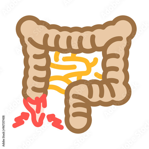 appendectomy surgery color icon vector. appendectomy surgery sign. isolated symbol illustration