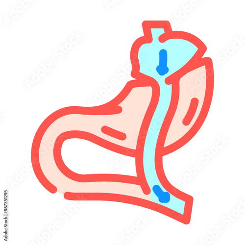 gastric bypass surgery color icon vector. gastric bypass surgery sign. isolated symbol illustration