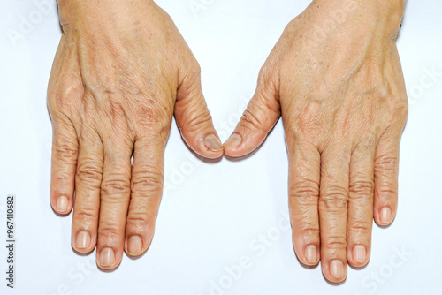 Closeup view of woman's hands with aging skin, top view