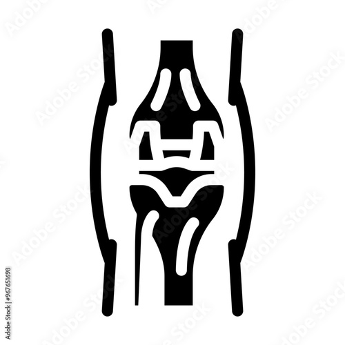 joint replacement surgery glyph icon vector. joint replacement surgery sign. isolated symbol illustration