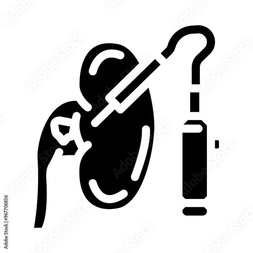 percutaneous nephrolithotomy surgery glyph icon vector. percutaneous nephrolithotomy surgery sign. isolated symbol illustration