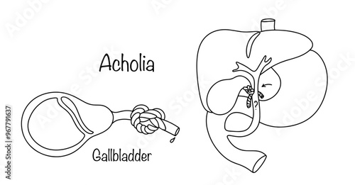 Acholia