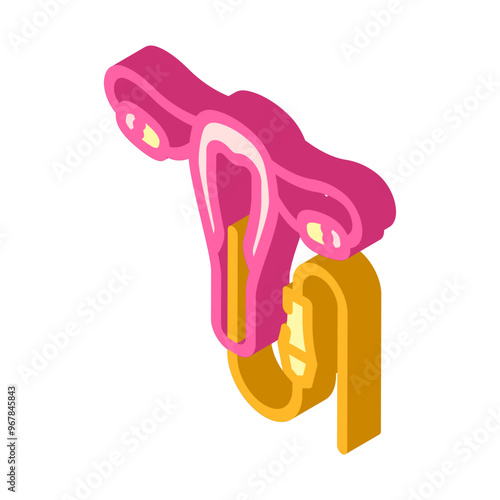 hysteroscopy surgery isometric icon vector. hysteroscopy surgery sign. isolated symbol illustration