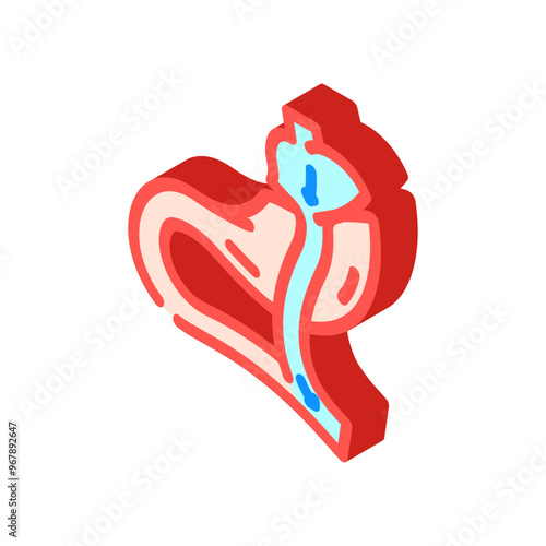 gastric bypass surgery isometric icon vector. gastric bypass surgery sign. isolated symbol illustration