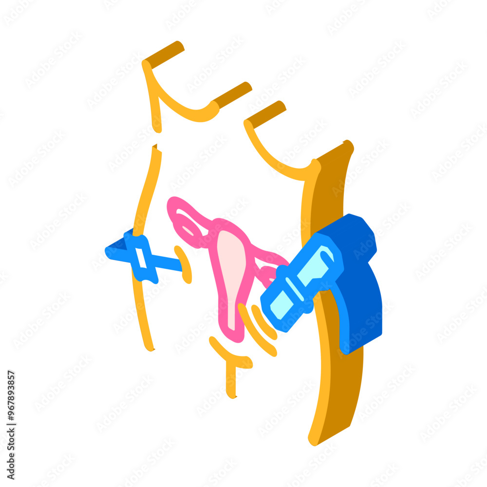 gynecologic laparoscopy surgery isometric icon vector. gynecologic laparoscopy surgery sign. isolated symbol illustration