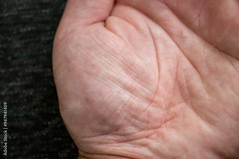 Detailed view of the skin texture on the inner palm of a hand, showing patterns and lines. Detailed view of the skin texture on the inner palm of a hand, showing patterns and lines.