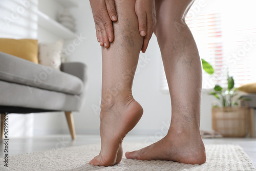 Fotografie Woman suffering from varicose veins indoors, closeup