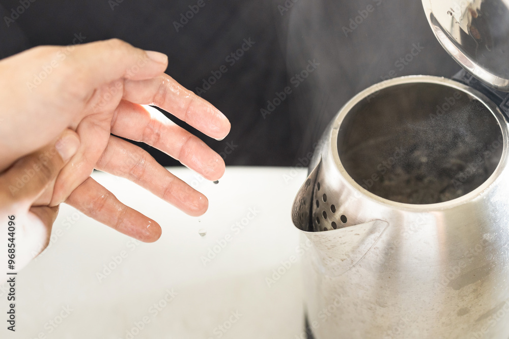 Woman’s hands with burning pain from scalding heat water,boiling water