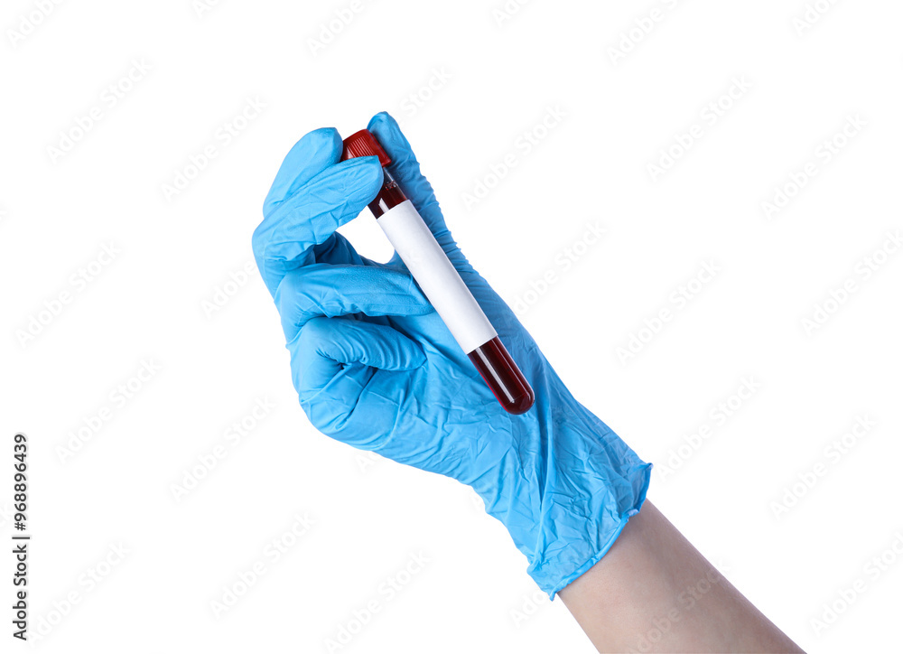 Laboratory worker holding test tube with blood sample and blank label on white background, closeup. Medical analysis Laboratory worker holding test tube with blood sample and blank label on white background, closeup. Medical analysis