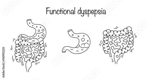Functional dyspepsia