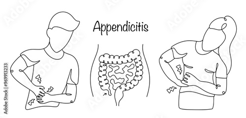 Appendicitis