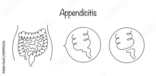 Appendix