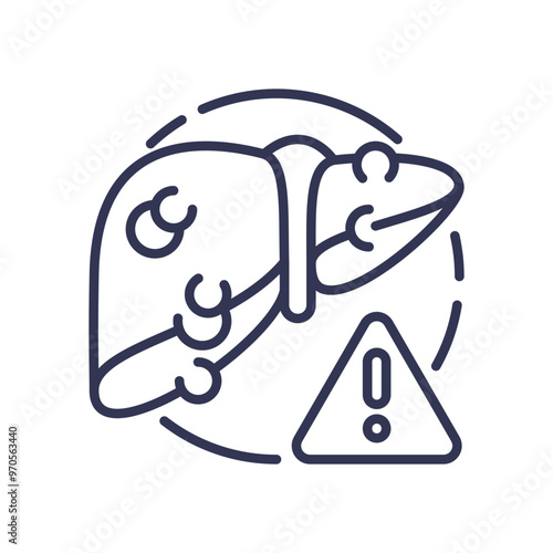 Illustration of a liver with a warning sign, symbolizing liver health issues and progression warning.
