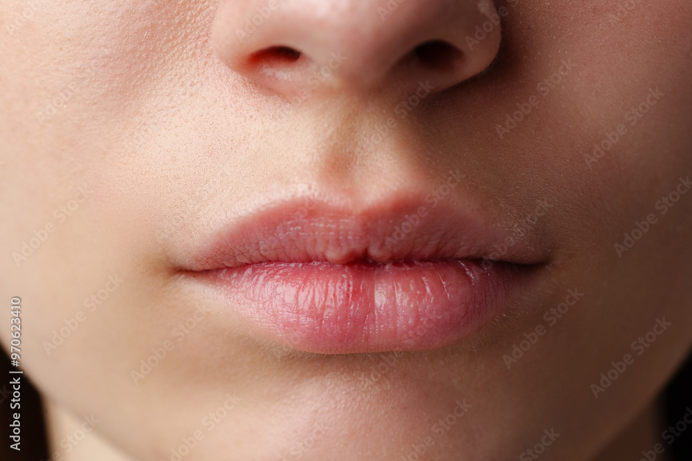 Obraz premium Close Up of a Woman's Lips With Dry Skin